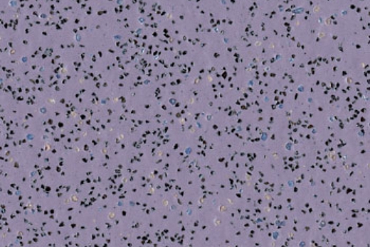 Liuni SpA Pavimenti vinilici antiscivolo POLYSAFE STANDARD - 8